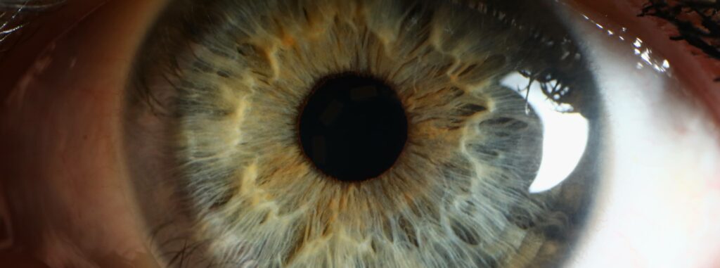 geographicatrophy.info - Join us on our journey in Geographic Atrophy